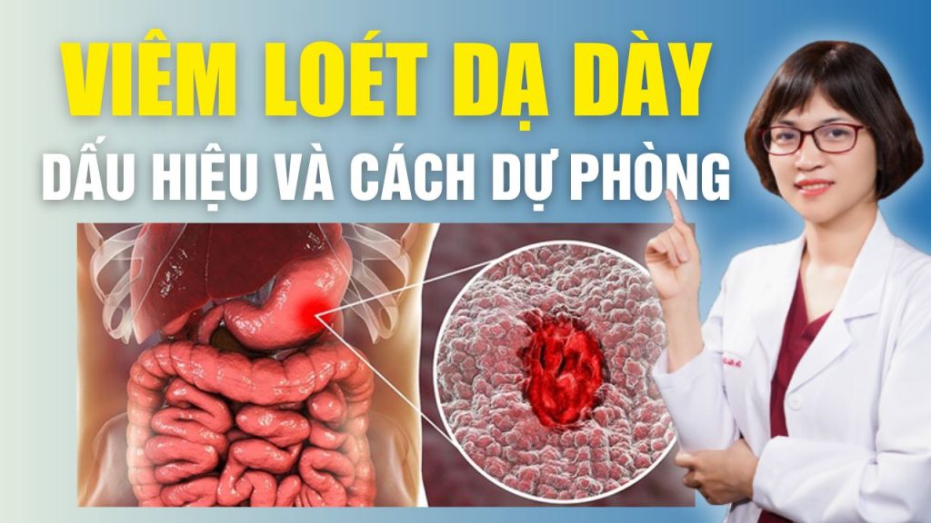 Bệnh viêm loét dạ dày Bs Mai Hoa