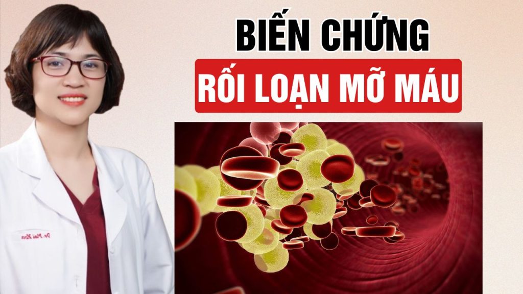 Rối loạn mỡ máu gây ra 7 biến chứng nguy hiểm