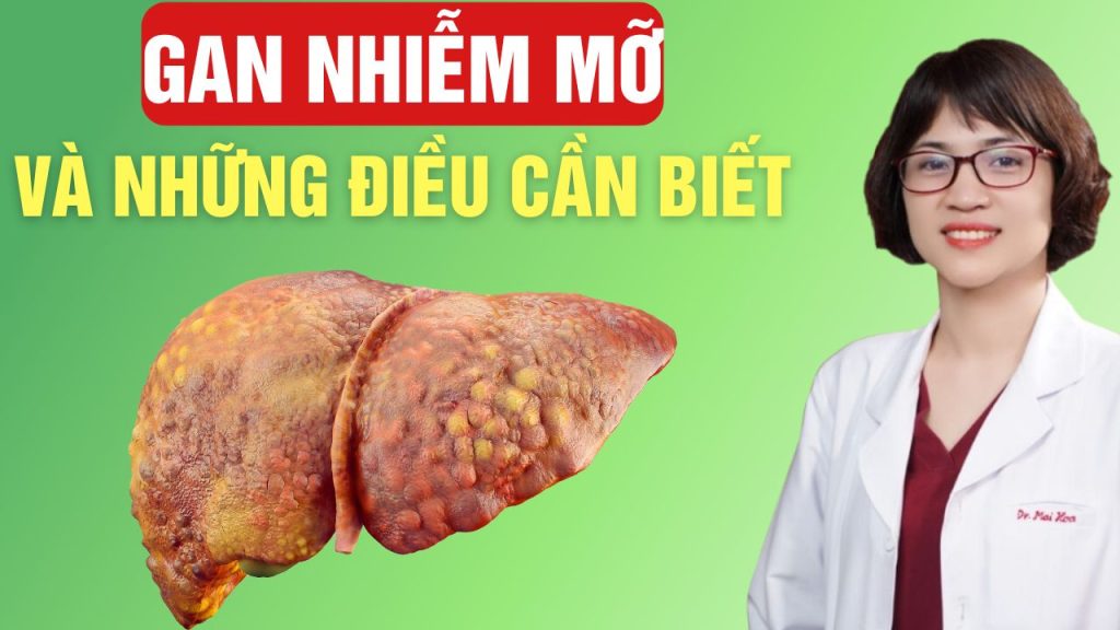 gan nhiễm mỡ và những điều cần biết để phòng ngừa