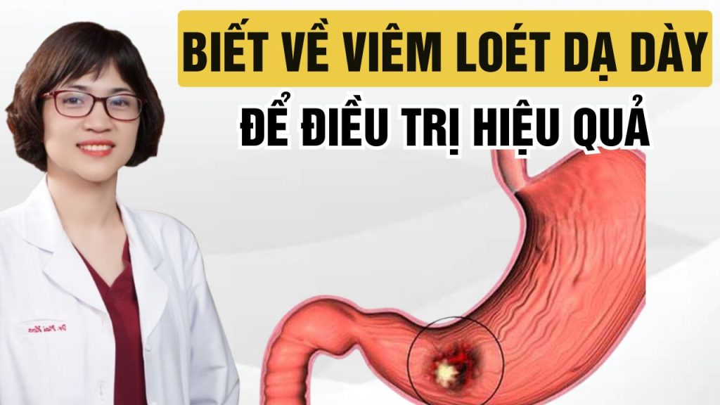 3 điều cần biết về viêm loét dạ dày