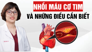 Nhồi máu cơ tim là gì? - 3 điều cần biết về nhồi máu cơ tim