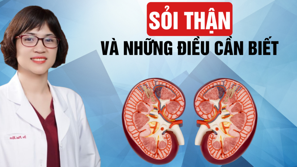 4 điều cần biết về sỏi thận