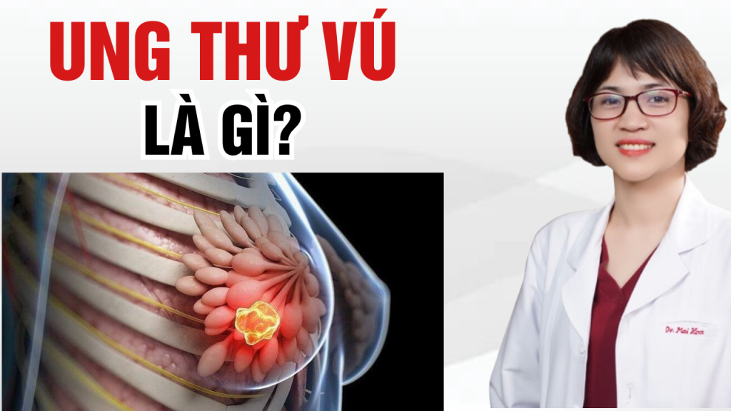 Ung thư vú là gì?